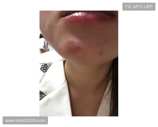 110Km h撞断行道树 我却只擦破点皮